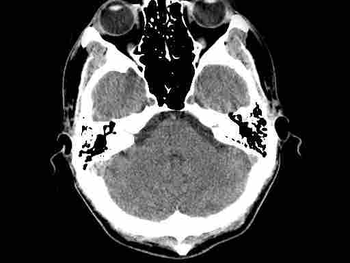 CT_Scan_Medical_Imaging